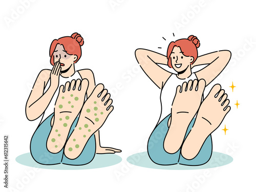Woman with rash on feet suffers from allergies and fungal infection that causes severe itching and odor. Sad and happy girl before and after applying healing cream to fight fungus on feet