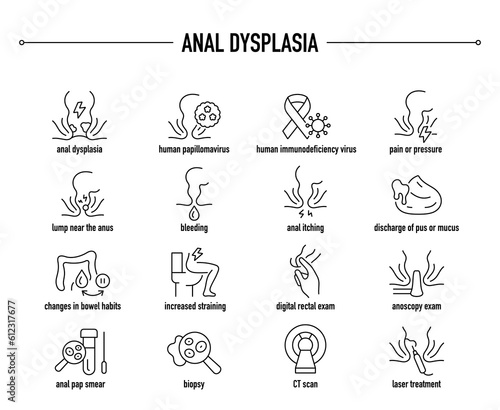 Anal Dysplasia symptoms, diagnostic and treatment vector icon set. Line editable medical icons.