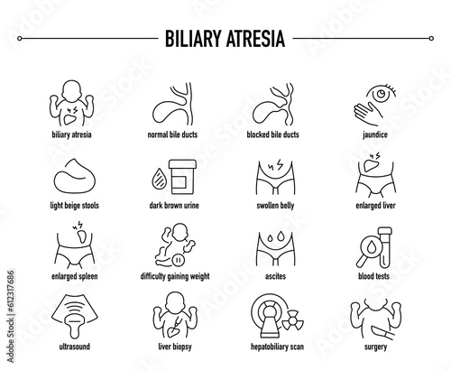 Biliary Atresia symptoms  diagnostic and treatment vector icon set. Line editable medical icons.