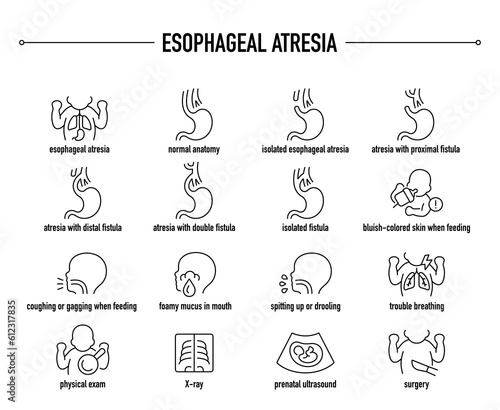Esophageal Atresia symptoms, diagnostic and treatment vector icon set. Line editable medical icons. photo