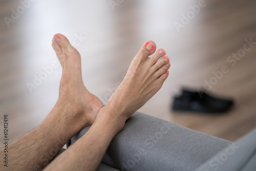 Tired man resting after work at home, male feet with fungus, body care concept