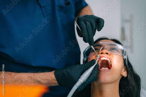 Teeth polishing photo