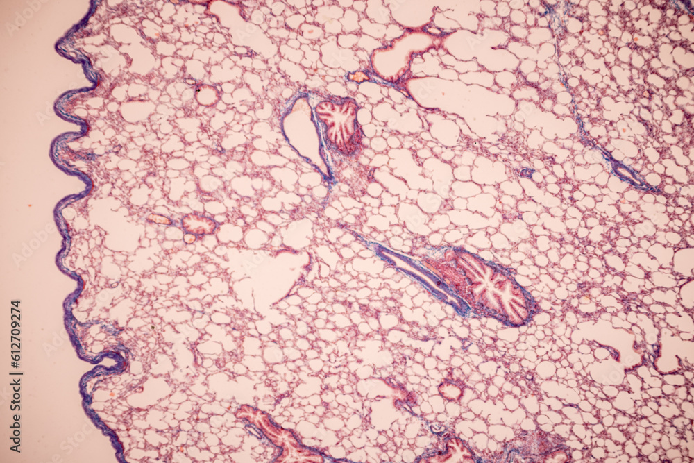 Human lung pathology under light microscope, The lungs is organs of the
