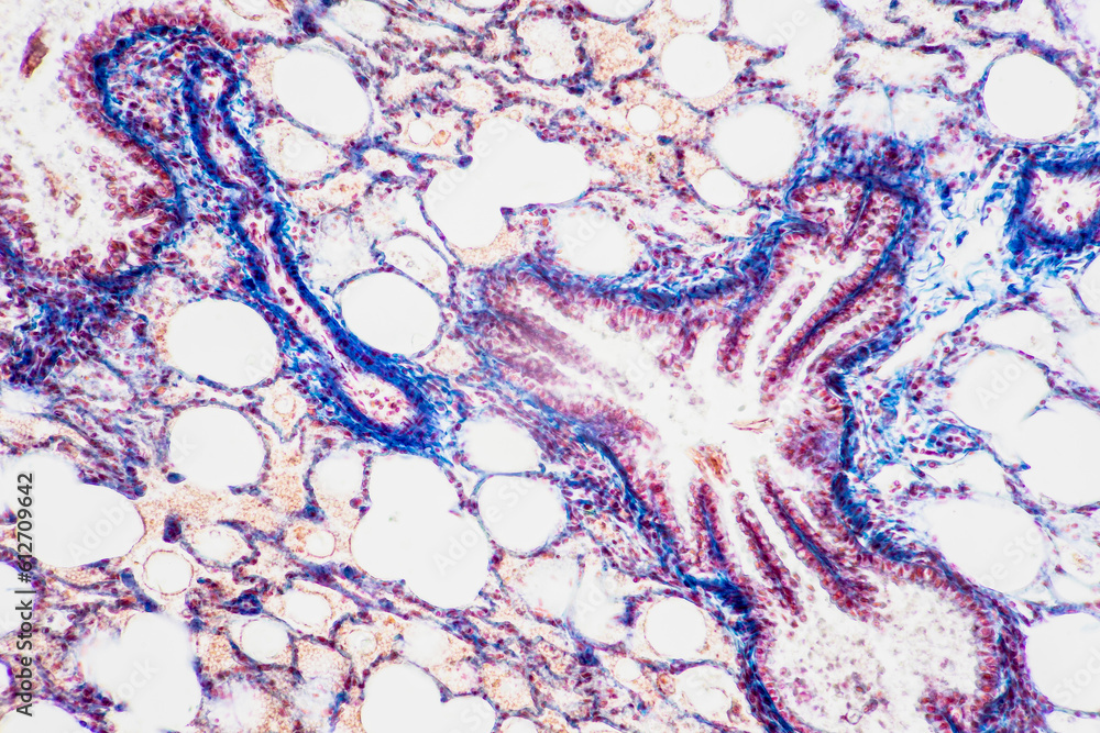 Fototapeta premium Human lung pathology under light microscope, The lungs is organs of the respiratory system in humans.