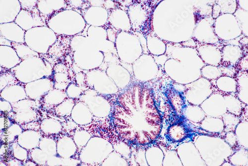 Human lung pathology under light microscope, The lungs is organs of the respiratory system in humans. photo