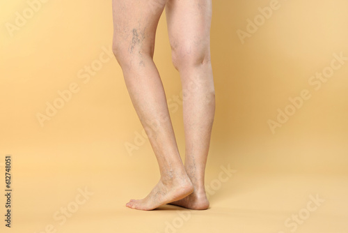 Closeup view of woman with varicose veins on yellow background © New Africa