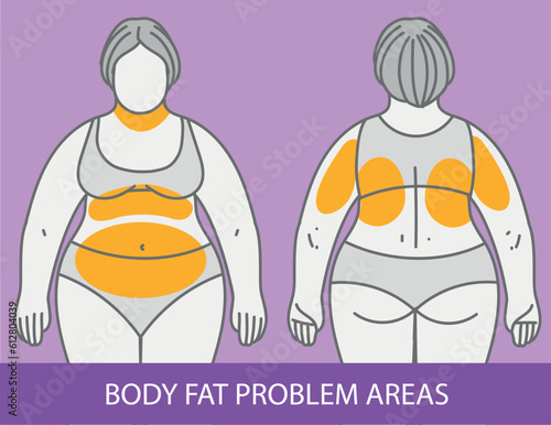 Body fat problem areas. Medical infographic. Healthcare illustration. Vector illustration. 