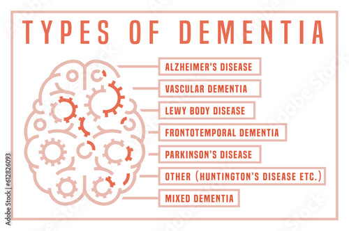 Vector dementia infographic in outline style. Editable illustration