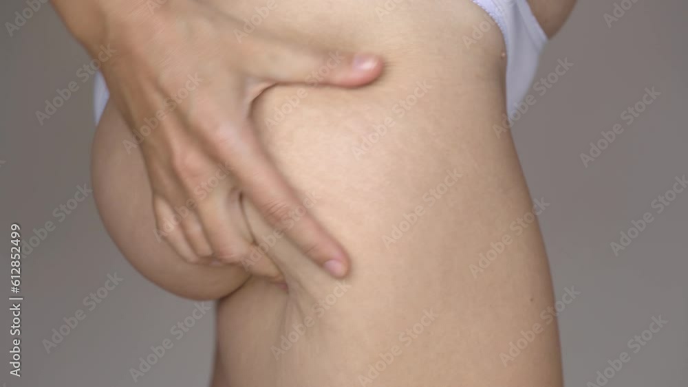 custom made wallpaper toronto digitalClose-up view of unrecognizable middle age woman wearing white underwear, squeezing skin of hip, buttock with hands, showing cellulite. Skin care, body care, lymphatic drainage, obesity 4K