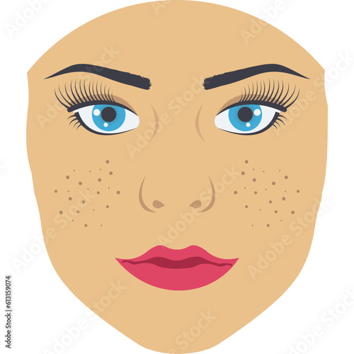 Freckles