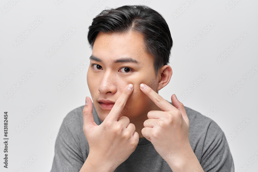 Handsome man touching his face. Squeezing pimple. Handsome man touching his face. Squeezing pimple.