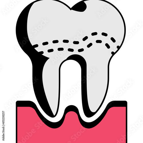 calculus or tartar concept, rough and hardened surface formed on teeth vector icon design, Dentures symbol, Oral Healthcare sign, Dental instrument stock illustration 