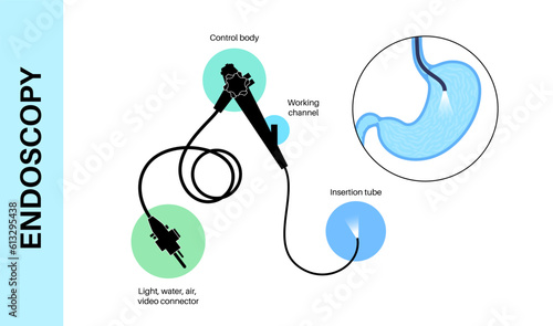 Gastroscopy endoscopy procedure photo