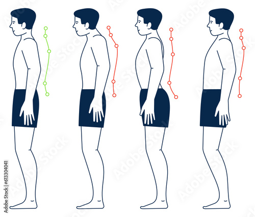 Male body with right and wrong spine postures. Body positions