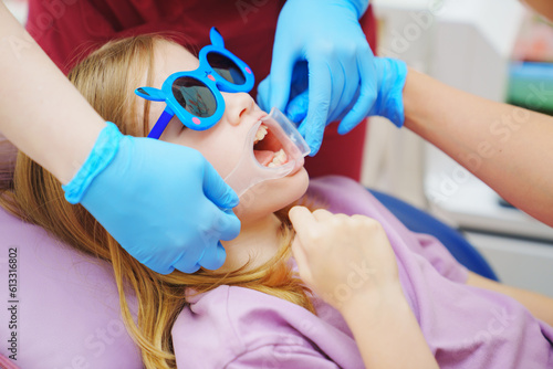 The pediatric dentist installs cheek and lip retractor for takes photos