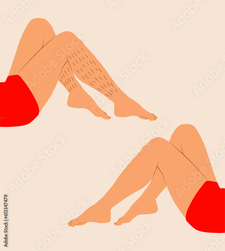 Woman legs. Woman legs icon. Sexy woman legs