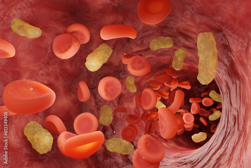Red blood cells and yellow bacteria flowing in blood vessel. Illustration of the concept of a severe medical condition sepsis in which bacteria enter the blood photo