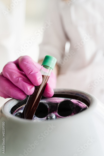 Close-up inserting test tube with blood in centrifuge to get plasma of patient girl for PRP Platelet Rich Plasma procedure. Platelet Rich Plasma PRP for improves skin volume and texture.