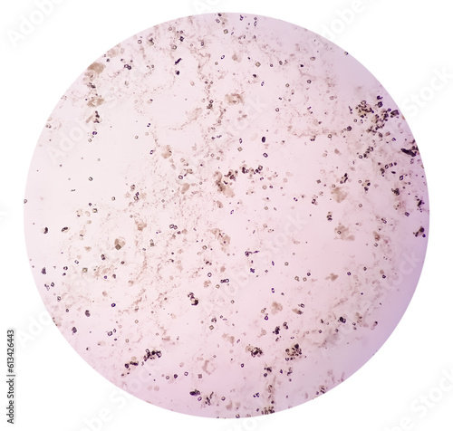 Bacteria colony on culture media plate, stool culture