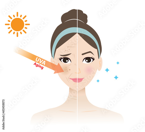 UVA rays penetrate into the woman face, resulting in a melasma, aging, wrinkle, tan, photoaging and dark spots vector isolated on white background. Comparison of damaged and beauty skin.
