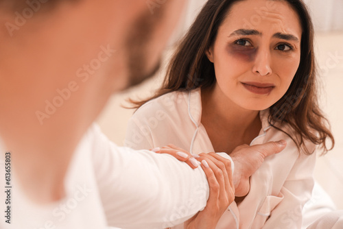 bruised young woman with he...