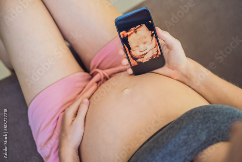 Bild auf Leinwand Pregnant woman holding and showing mobile phone with fetal ultrasound photo