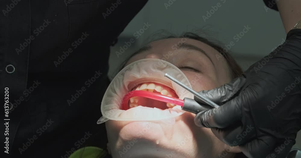 Dentist removes excess saliva from the patient's mouth with a saliva ejector. Blow out mouth