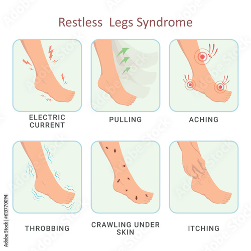 Restless legs syndrome electric current pulling aching throbbing crawling skin itching vector flat
