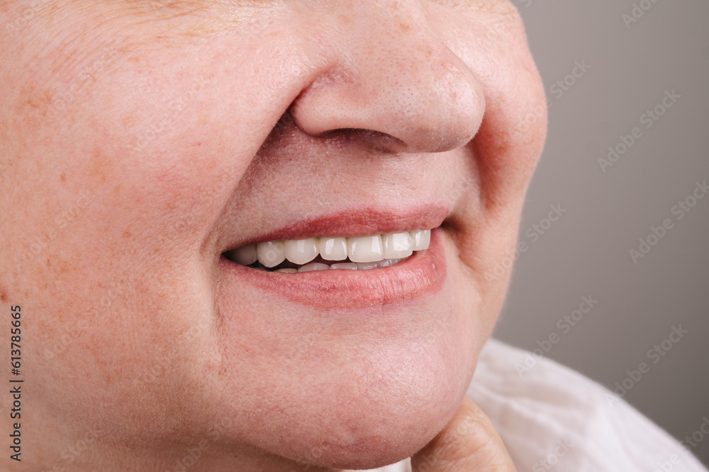 Obraz premium A Captivating Smile: Unleashing the Power of a Transformed Confidence