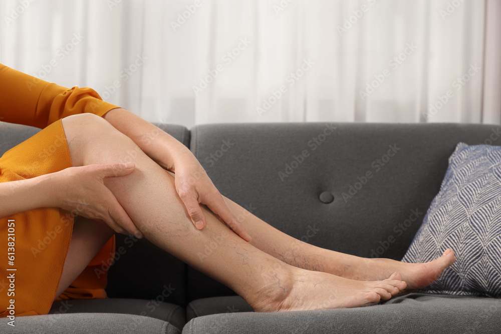 Barefoot woman with varicose veins resting on sofa in room, closeup Barefoot woman with varicose veins resting on sofa in room, closeup
