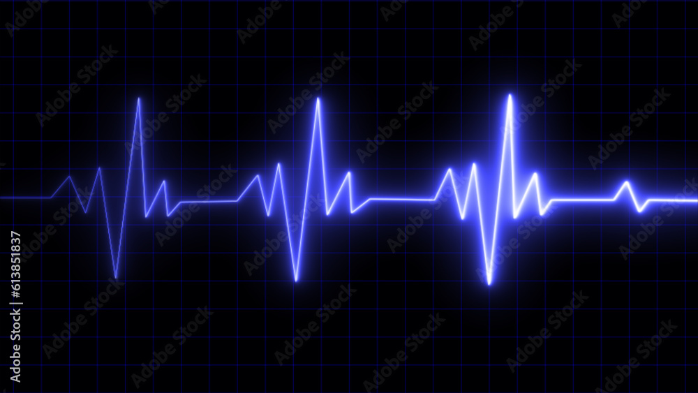 EKG monitoring in an emergency. heartbeat under bright blue light. The heartbeat. Electrocardiogram. Circulatory Heartbeat Signal Pulse