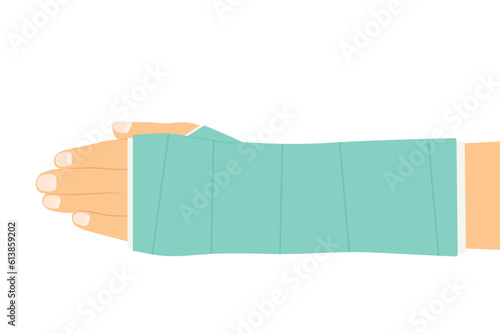 broken hand with plaster - vector illustration