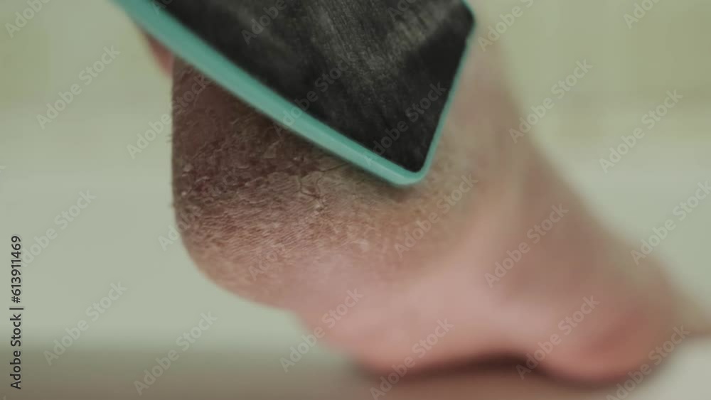 Cleaning dry skin on heels. Foot care and hygiene. Podology. Cracking