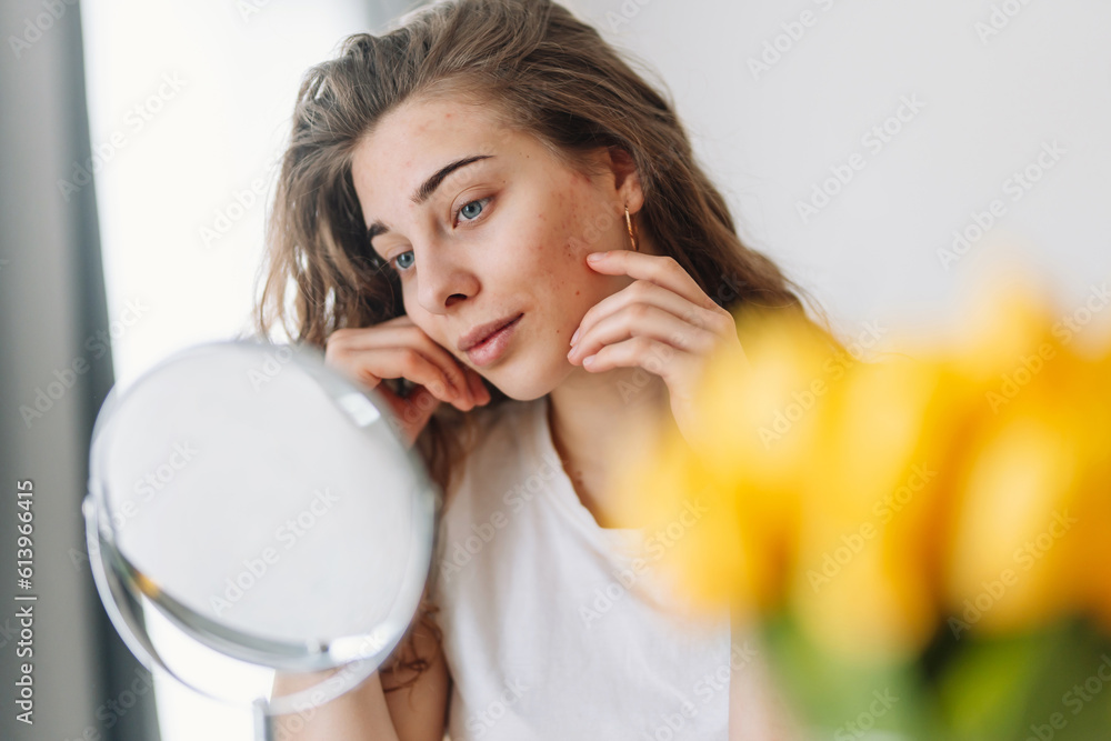 oung woman with problem skin looking into mirror. Dermatology. Allergic reaction from cosmetic, red spot or rash on face. oung woman with problem skin looking into mirror. Dermatology. Allergic reaction from cosmetic, red spot or rash on face.