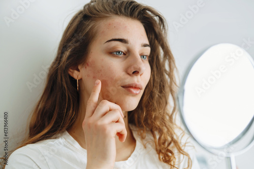 Foto oung woman with problem skin looking into mirror