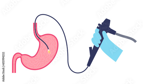 Gastroscopy endoscopy procedure