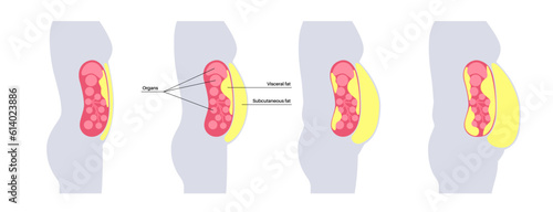 Visceral fat diagram