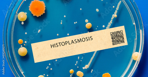 Histoplasmosis - Fungal infection that can cause respiratory illness and is acquired by inhaling spores from contaminated soil. photo