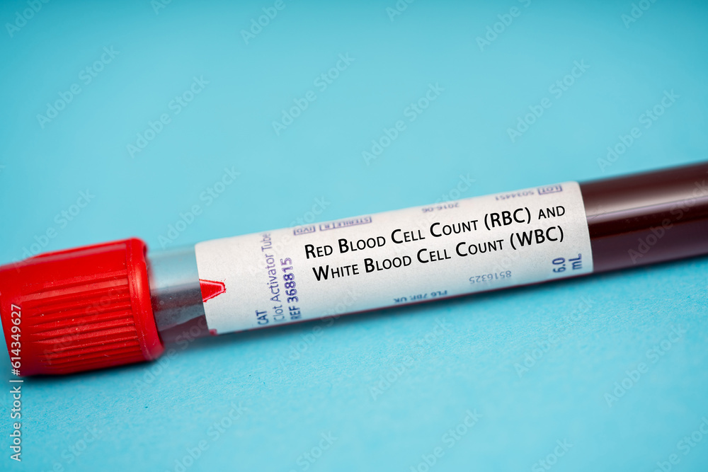 Red Blood Cell Count (RBC) And White Blood Cell Count (WBC) Test Red Blood Cell Count (RBC) And White Blood Cell Count (WBC) Test