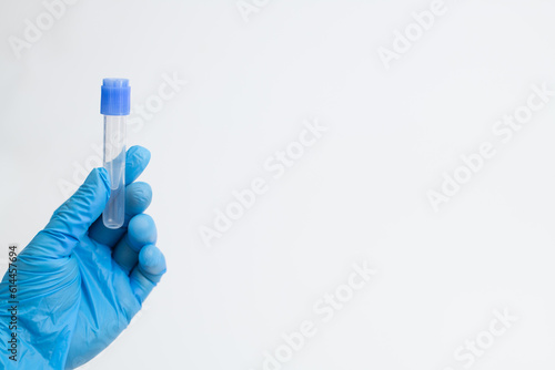 Vacuum tube for collection and blood samples with sodium citrate in blue gloves for laboratory. On white background