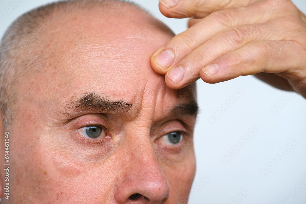 close-up of mature man, senior 60 years old looks carefully examines wrinkles around eyes, skin between eyebrows, age-related changes, aesthetic injection cosmetology, care anti-aging procedures