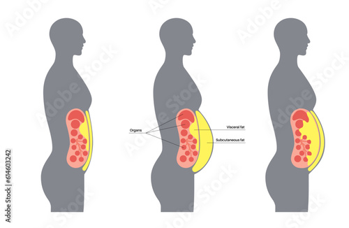 Visceral fat diagram