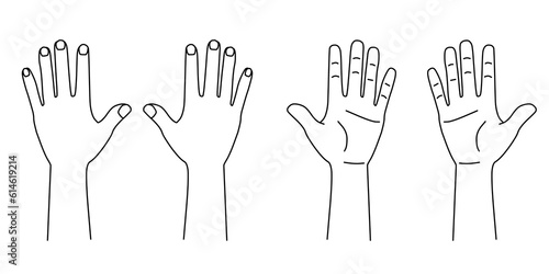 手の平手の甲両手のイラスト線画｜カルテなどの診療記録に使える