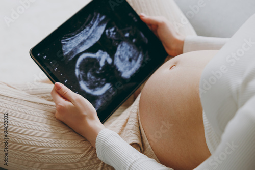 Cropped close up young pregnant woman wears white pyjamas hold in hand picture of ultrasound examination rest relax spend time in bedroom lounge home Fototapeta
