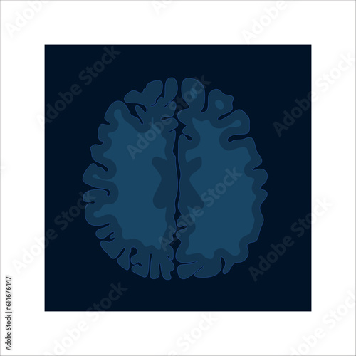 MRI brain scan icon. Medical imaging technology for mental health assessment and abnormality diagnostics. Activity visualization. Vector illustration isolated on white.