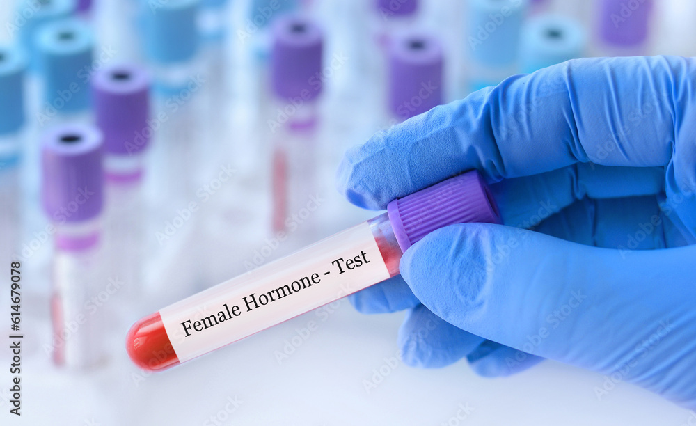 Doctor holding a test blood sample tube with female hormone test on the background of medical test tubes with analyzes.Copy space for text.