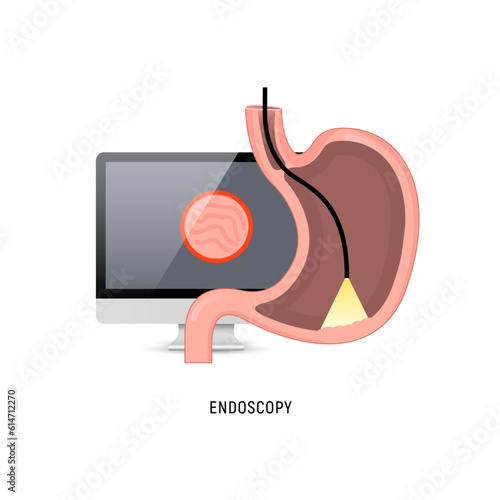 Endoscopy logo icon. Stomach gastroscopy cartoon gastritis medicine sign cancer egd system icon.