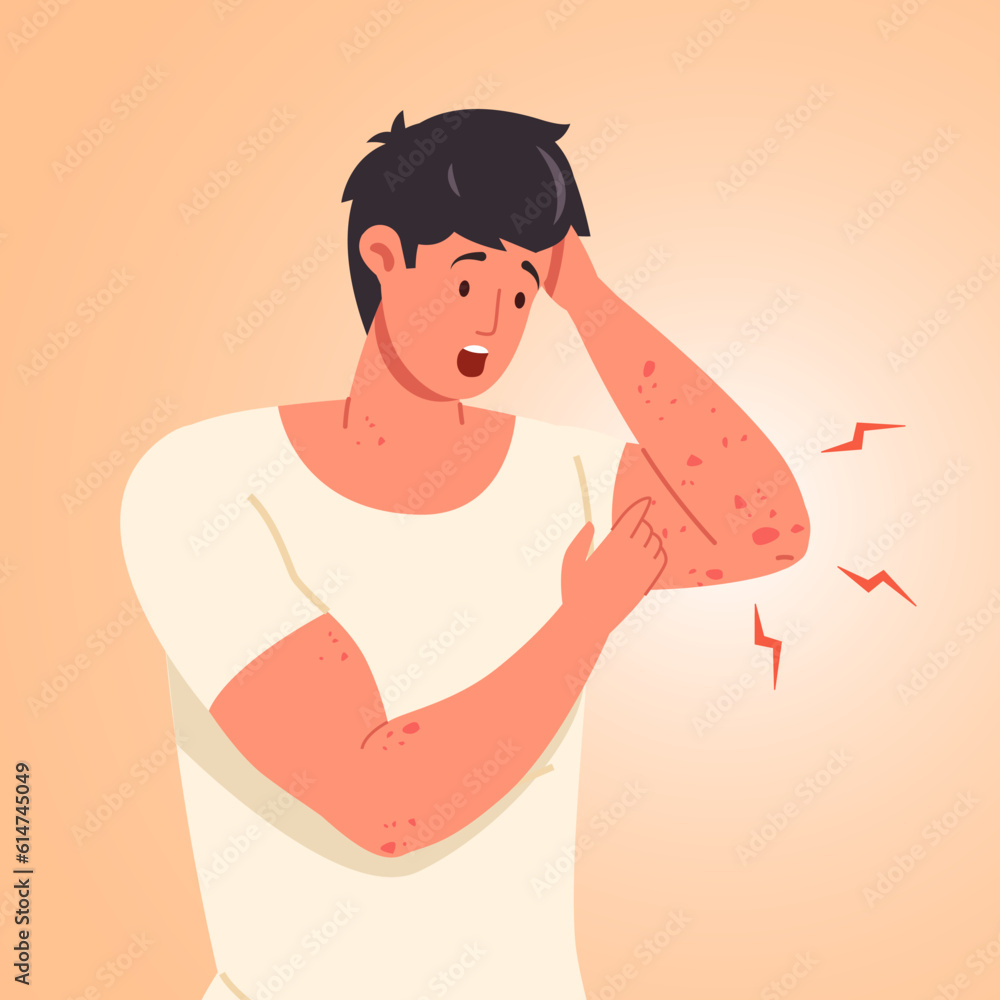 Man Scratching Skin Guy Scratch Sensitive Skins On Itchy Hand Scabies man-scratching-skin-guy-scratch-sensitive-skins-on-itchy-hand-scabies