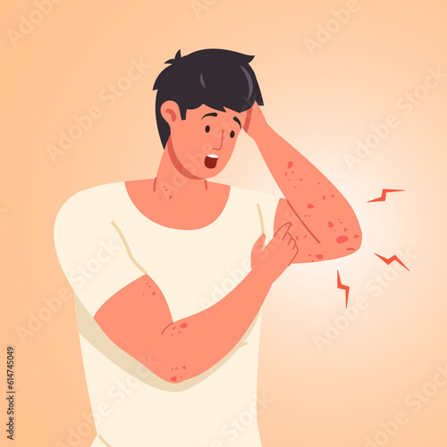 Man scratching skin. Guy scratch sensitive skins on itchy hand, scabies eczem rash inflammation or chickenpox symptoms, mosquito infection food allergy concept vector illustration