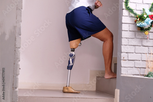 Disabled woman wearing prosthetic legs Prosthetic legs.